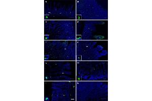 Visualization of OR51E1 tissue distribution in the gastrointestinal tract. (OR51E1 抗体)