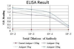 Red: Control Antigen (100 ng), Purple: Antigen (10 ng), Green: Antigen (50 ng), Blue: Antigen (100 ng), (ASK1 抗体)