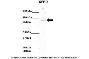 Lanes:   Lane 1: 50ug Hela Lysate  Primary Antibody Dilution:   1:1000  Secondary Antibody:   Anti-rabbit-HRP  Secondary Antibody Dilution:   1:10,000  Gene Name:   SFPQ  Submitted by:   Archa Fox, University of Western Australia  SFPQ is strongly supported by BioGPS gene expression data to be expressed in Human HeLa cells