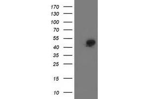 Western Blotting (WB) image for anti-Spermine Synthase, SMS (SMS) antibody (ABIN1501094) (SMS 抗体)