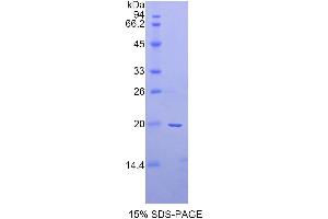 SDS-PAGE analysis of Rat a2PI Protein. (alpha 2 Antiplasmin 蛋白)