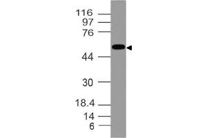 Image no. 1 for anti-Aldehyde Dehydrogenase 1 Family, Member A1 (ALDH1A1) (AA 284-492) antibody (ABIN5027017) (ALDH1A1 抗体  (AA 284-492))