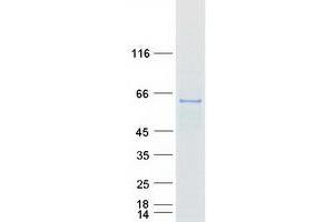 Validation with Western Blot (RNMT Protein (Myc-DYKDDDDK Tag))