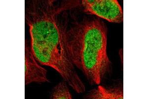 Immunofluorescent staining of U-2 OS with ARID1A polyclonal antibody  (Green) shows positivity in nucleus but excluded from the nucleoli. (ARID1A 抗体)