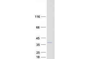 Western Blotting (WB) image for Zinc Finger CCHC-Type and RNA Binding Motif 1 (ZCRB1) protein (Myc-DYKDDDDK Tag) (ABIN2735808)