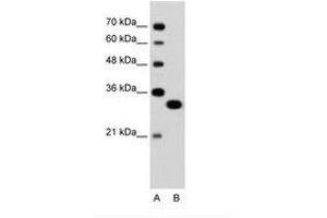 Image no. 1 for anti-Transcription Factor EC (TFEC) (AA 71-120) antibody (ABIN6736324) (TFEC 抗体  (AA 71-120))