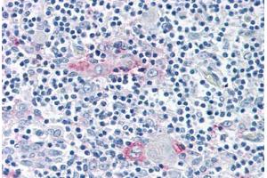 Anti-ROR Gamma antibody  ABIN1049300 IHC staining of human thymus.