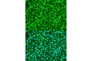 Immunofluorescence analysis of U2OS cells using BDNF antibody. (BDNF 抗体  (AA 20-247))