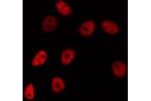 ABIN6275739 staining HepG2 by IF/ICC. (FEV 抗体  (N-Term))