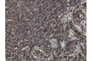Image no. 1 for anti-Hematopoietic Cell-Specific Lyn Substrate 1 (HCLS1) (AA 266-356) antibody (ABIN598724) (HCLS1 抗体  (AA 266-356))