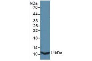 Western blot analysis of recombinant Mouse IL13Ra2. (IL13RA2 抗体  (AA 228-338))