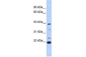 PEF1 antibody used at 1 ug/ml to detect target protein. (PEF1 抗体  (Middle Region))