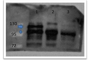 Western Blot of Rabbit anti-catenin ß-1 antibody Lane 1: zebrafish embryos injected with myc tagged catenin ß 1 mRNA Lane 2: zebrafish embryos injected with myc tagged catenin ß 2 mRNA Lane 3: zebrafish embryos un-injected Primary antibody: catenin ß-1 antibody at 1:500 overnight at 4°C Secondary antibody: goat anti-rabbit HRP at 1:10,000 for 1 hour at RT Predicted/Observed size: 85. (beta Catenin 抗体  (C-Term))