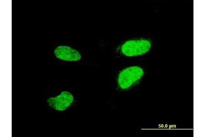 Immunofluorescence of monoclonal antibody to ATF2 on HeLa cell. (ATF2 抗体  (AA 1-209))