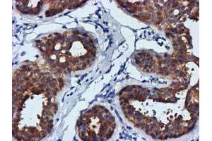 Immunohistochemical staining of paraffin-embedded Human breast tissue using anti-FGFR2 mouse monoclonal antibody. (FGFR2 抗体)