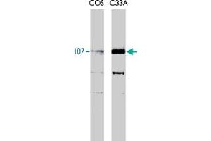 Rbl1 monoclonal antibody, clone KAB6  recognizes both the phosphorylated and unphosphorylated forms of p107 at 107kDa. (p107 抗体)