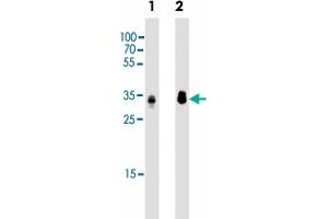 Western blot analysis of Lane 1: Hela whole cell lysates Lane 2: HepG2 whole cell lysates reacted with PPT1 monoclonal antibody  at 1:2000 dilution. (PPT1 抗体)
