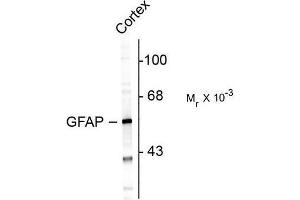 Image no. 1 for anti-Glial Fibrillary Acidic Protein (GFAP) antibody (ABIN372651) (GFAP 抗体)