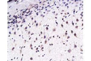 Immunohistochemistry (Paraffin-embedded Sections) (IHC (p)) image for anti-EPH Receptor B2 (EPHB2) (AA 551-650) antibody (ABIN730708) (EPH Receptor B2 抗体  (AA 551-650))