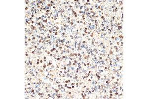 Immunohistochemistry of paraffin-embedded human spleen using SHIP11 Rabbit mAb (ABIN7267882) at dilution of 1:100 (40x lens). (INPP5D 抗体)