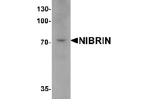 Western blot analysis of NIBRIN in mouse lung tissue lysate with NIBRIN antibody at 1 µg/mL. (Nibrin 抗体  (C-Term))