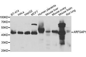 Western blot analysis of extracts of various cell lines, using ARFGAP1 antibody. (ARFGAP1 抗体)