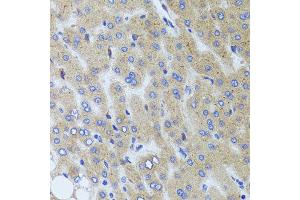 Immunohistochemistry of paraffin-embedded human liver injury using SYNPO antibody at dilution of 1:100 (x40 lens). (SYNPO 抗体)
