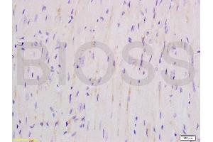 Formalin-fixed and mouse heart tissue labeled with Anti-SOD2 Polyclonal Antibody, Unconjugated (ABIN737361) at 1:200 followed by conjugation to the secondary antibody and DAB staining (SOD2 抗体  (AA 41-78))