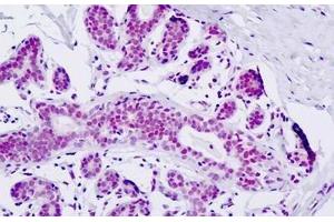 Immunohistochemistry (IHC) image for anti-Zinc Finger, MYND-Type Containing 8 (ZMYND8) (AA 581-630) antibody (ABIN2879245)