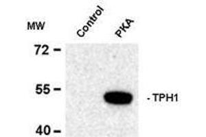 Image no. 1 for anti-Tryptophan Hydroxylase 1 (TPH1) (pSer58) antibody (ABIN372732) (Tryptophan Hydroxylase 1 抗体  (pSer58))