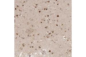 Immunohistochemical staining of human lateral ventricle with FAM211A polyclonal antibody  shows strong cytoplasmic positivity in neuronal cells at 1:20-1:50 dilution. (LRRC75A/FAM211A 抗体)