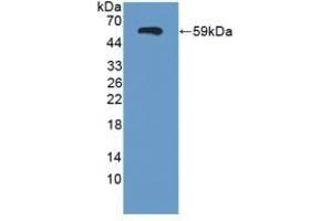 Western Blotting (WB) image for anti-Sema Domain, Immunoglobulin Domain (Ig), Short Basic Domain, Secreted, (Semaphorin) 3E (SEMA3E) (AA 32-516) antibody (ABIN7430111)