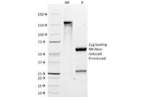 SDS-PAGE Analysis of Purified, BSA-Free MART-1 Antibody (clone M2-7C10).