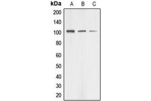 Western blot analysis of AASS expression in HUVEC (A), HeLa (B), HEK293T (C) whole cell lysates. (AASS 抗体  (Center))