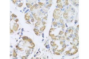 Immunohistochemistry of paraffin-embedded Human stomach using PRKAG1 Polyclonal Antibody at dilution of 1:100 (40x lens). (PRKAG1 抗体)