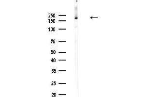 Western blot analysis of lysates from PC12 cells(heat-shock,45 min treatment), using Clathrin Antibody at 1/1000 dilution. (Clathrin 抗体  (C-Term))