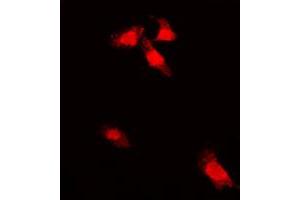 Immunofluorescent analysis of G3BP1 (pS232) staining in A549 cells. (G3BP1 抗体  (pSer232))
