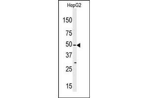 Image no. 1 for anti-Mitogen-Activated Protein Kinase Kinase Kinase MLT (ZAK) (Middle Region) antibody (ABIN360531) (ZAK 抗体  (Middle Region))