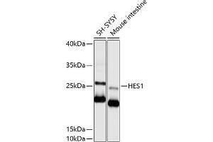 Western blot analysis of extracts of various cell lines, using HES1 antibody (ABIN6129271, ABIN6141726, ABIN6141728 and ABIN6215415) at 1:1000 dilution. (HES1 抗体  (AA 151-280))