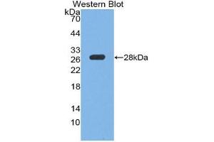 Western blot analysis of the recombinant protein. (PTPRS 抗体  (AA 889-1102))