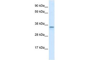 Human brain; WB Suggested Anti-CGI-62 Antibody Titration: 1. (FAM164A 抗体  (C-Term))