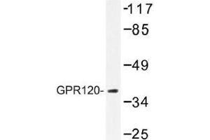 Image no. 1 for anti-omega-3 Fatty Acid Receptor 1 (O3FAR1) antibody (ABIN317737) (O3FAR1 抗体)