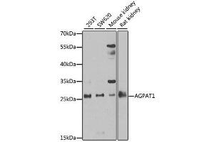 Western blot analysis of extracts of various cell lines, using AGPAT1 antibody. (AGPAT1 抗体  (AA 204-283))