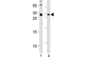 Western blot analysis of lysate from (1) mouse brain and (2) mouse skeletal muscle tissue lysate using Olig3 antibody at 1:1000. (OLIG3 抗体  (N-Term))