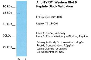 Host: Rabbit  Target Name: TYRP1  Sample Tissue: Human 721_BLane A:  Primary Antibody Lane B:  Primary Antibody + Blocking Peptide Primary Antibody Concentration: 1 µg/mL Peptide Concentration: 5. (Tyrosinase-Related Protein 1 抗体  (Middle Region))