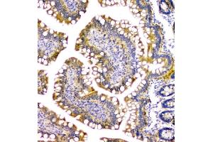 anti-Phosphopantothenoylcysteine Synthetase (PPCS) antibody