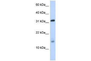 EIF1AX antibody used at 1 ug/ml to detect target protein. (EIF1AX 抗体  (Middle Region))