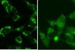 Immunofluorescence (IF) image for anti-Microtubule-Associated Protein 1 Light Chain 3 beta (MAP1LC3B) (AA 89-122) antibody (ABIN3031786)