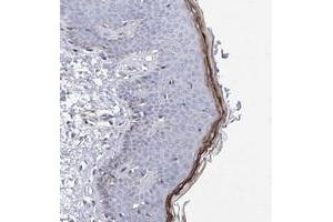 Immunohistochemical staining of human skin with HRNR polyclonal antibody  shows distinct positivity in granular layer cells. (HRNR 抗体)