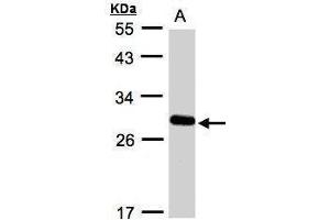 Western blot analysis of 30 ug whole cell lysate (A:A431) using a 12 % SDS PAGE gel and YIPF4 antibody at a dilution of 1:1000 (YIPF4 抗体)
